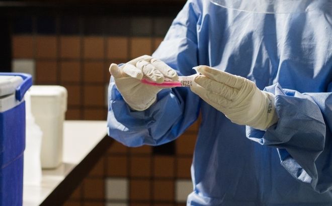 Teste de covid-19 (Foto: Divulgação/Fiocruz)