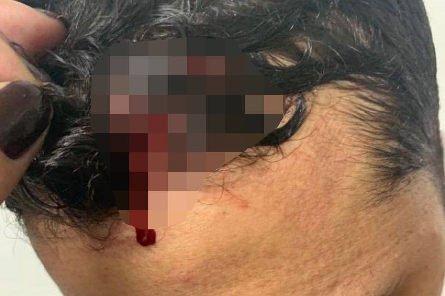 Rapaz é agredido por guardas em show de Praia Grande e fica ferido: ‘Desmaiei na hora’