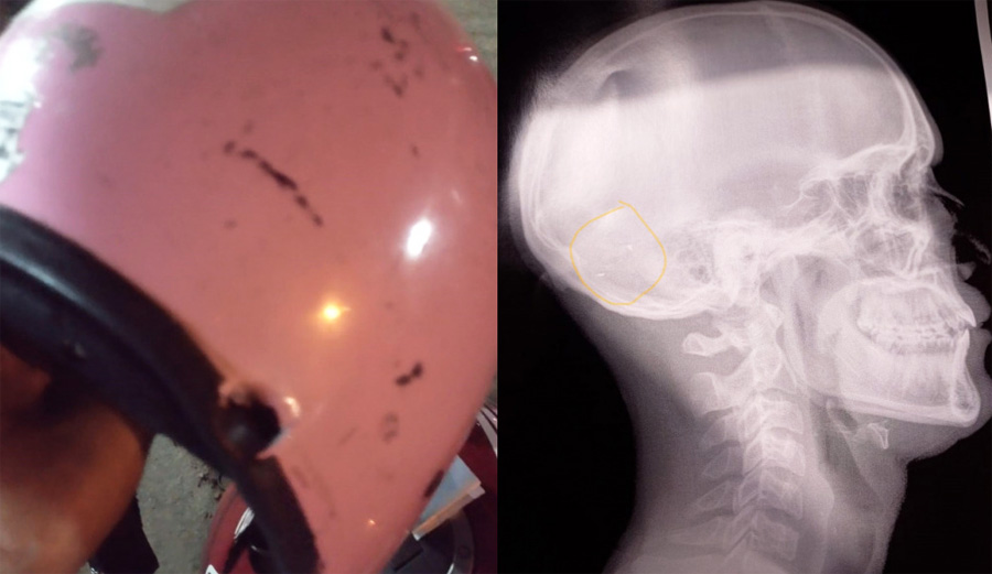 Montagem Santa Portal