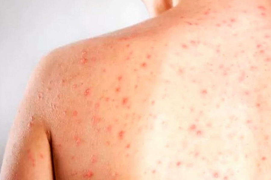 Reprodução/Imagem Ilustrativa