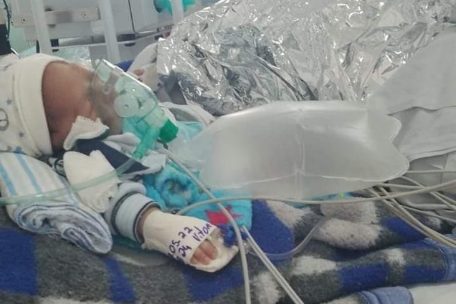 Bebê prematuro respira por aparelhos e aguarda vaga em UTI pediátrica em Guarujá