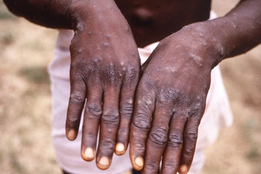 Reprodução/CDC/BRIAN W.J. MAHY