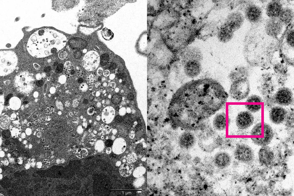 Imagem da variante ômicron capturada por cientistas da Universidade de Hong Kong - HKU-MED