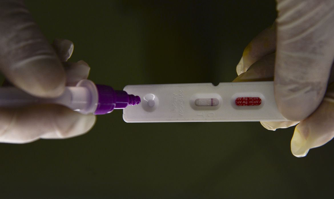 Brasil registra 65 mortes por Covid e 924 casos 