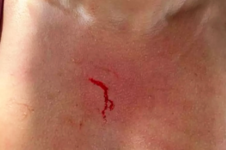 Reprodução/Instagram