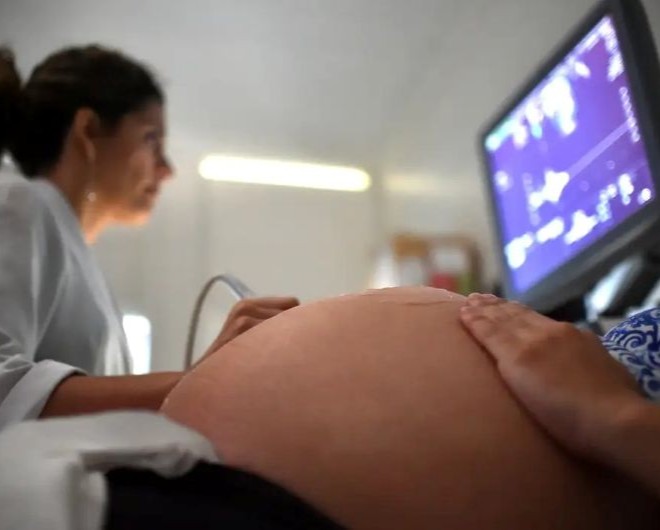 André Borges/Agência Brasília