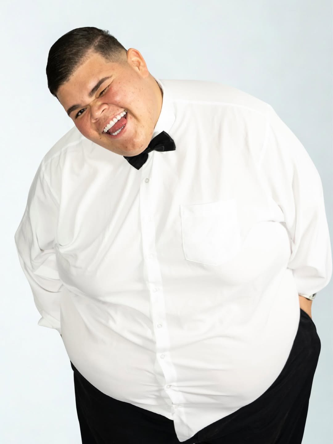 Gordão da XJ abre o jogo sobre bariátrica e cirurgias após eliminar 130 kg