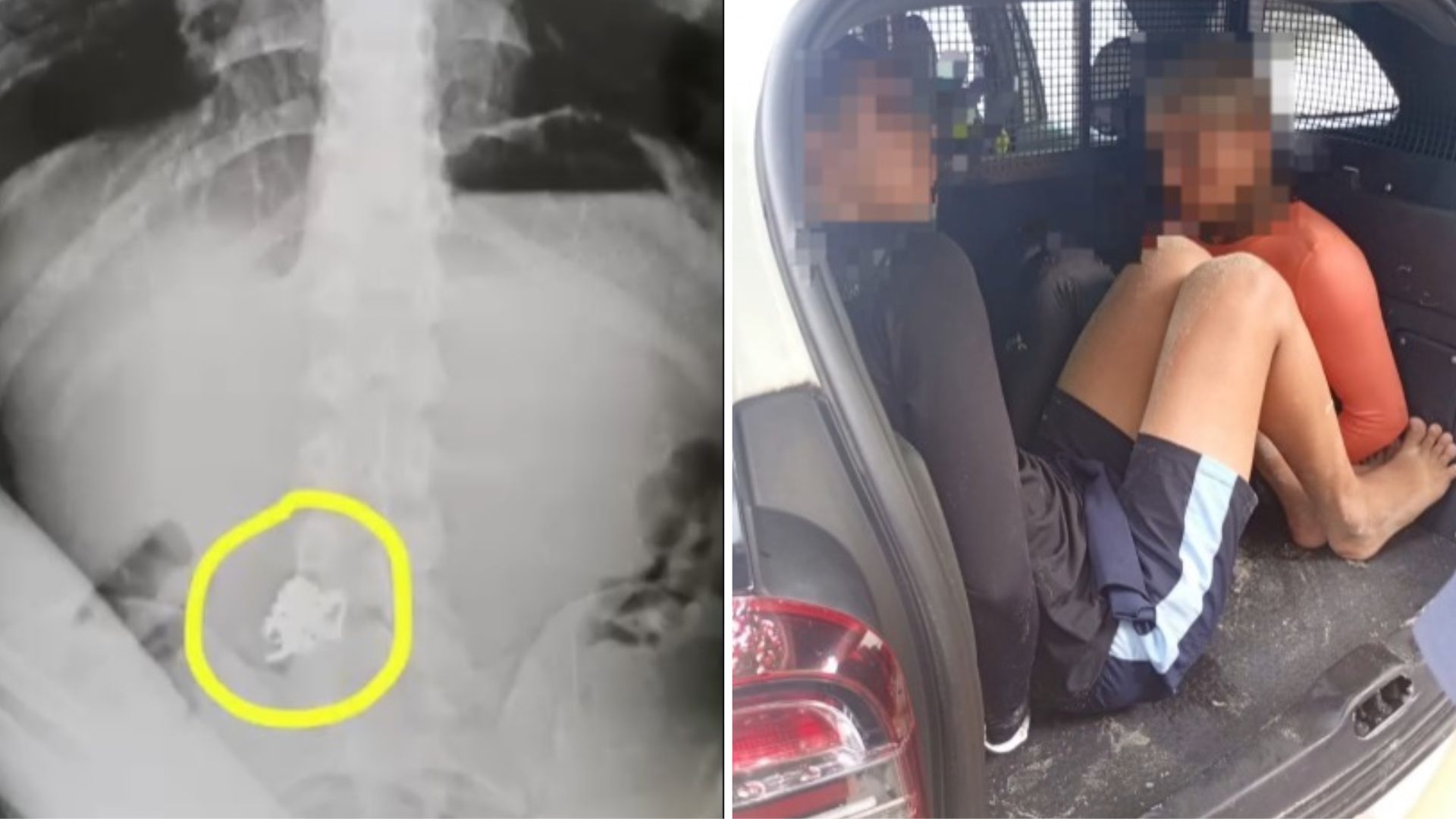 Criminoso engole corrente de ouro após roubo e acaba preso com comparsa em Guarujá