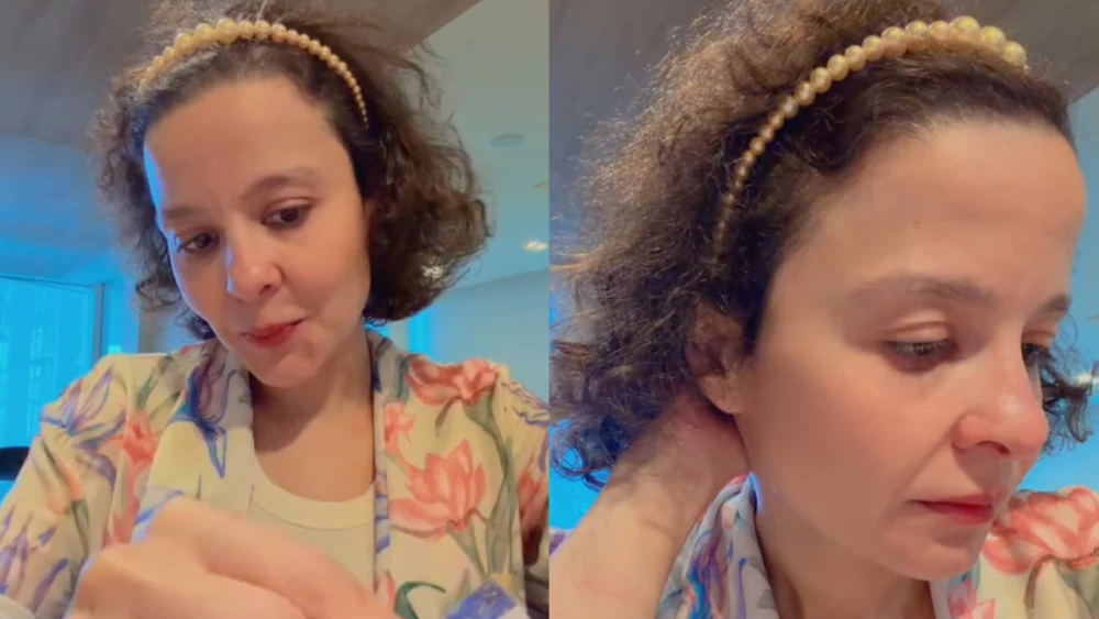 Maiara, da dupla com Maraisa, desabafa sobre alopécia