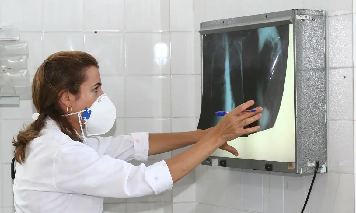 Campanha contra a tuberculose será permanente em Santos