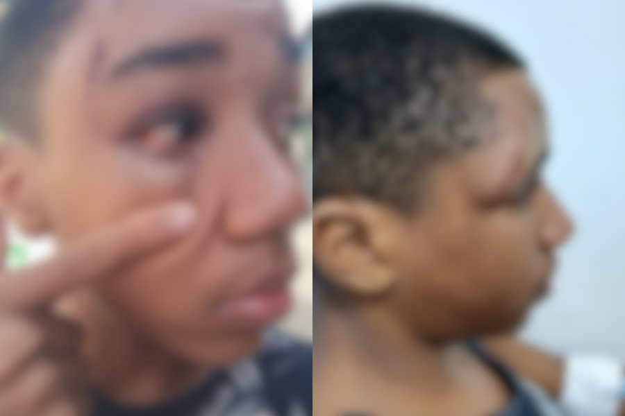 Adolescente fica ferido após acidente em playground de Santos