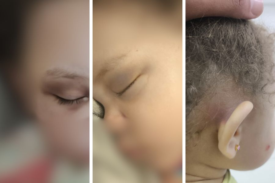 Pai denuncia agressão contra filha de 2 anos em escola municipal de Praia Grande