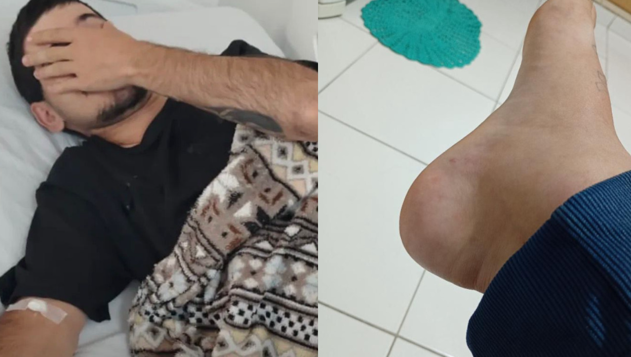 Jovem é surpreendido após ser picado por cobra em Praia Grande